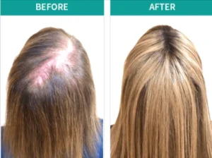 Benefits-of-BioGrow-RX